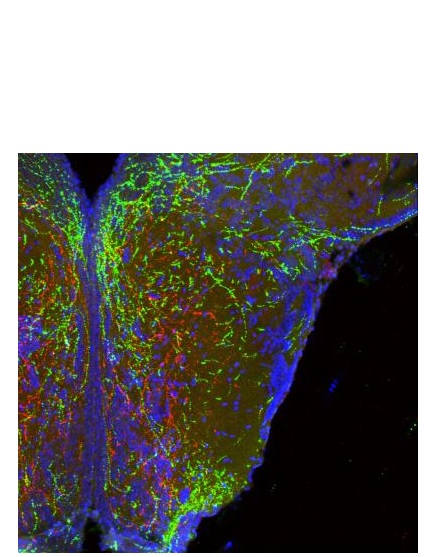 De longues projections filaires de neurones dans l'hypothalamus forment des circuits de poids corporel (en rouge et en vert ). De longues projections filaires de neurones dans l'hypothalamus forment des circuits de poids corporel (en rouge et en vert ).