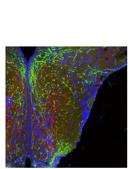  De longues projections filaires de neurones dans l'hypothalamus forment des circuits de poids corporel (en rouge et en vert ). 