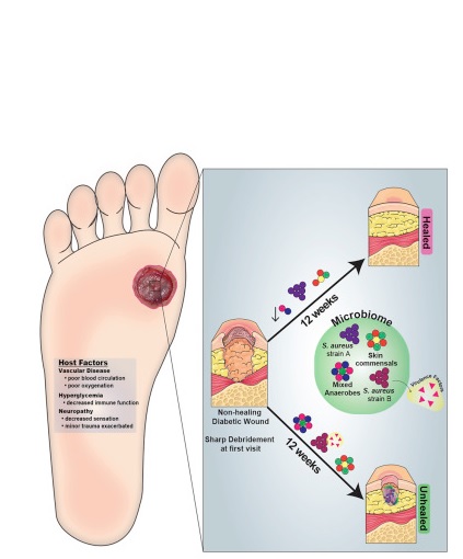 A. Faecalis semble stimuler une inflammation bénéfique de la peau lésée qui limite les effets néfastes de bactéries plus nocives. A. Faecalis semble stimuler une inflammation bénéfique de la peau lésée qui limite les effets néfastes de bactéries plus nocives.