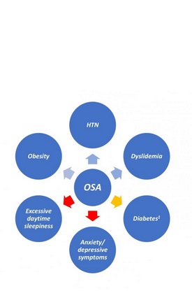 le SAOS est associé à l'obésité, à l'hypertension et à la dyslipidémie (flèches bleues), mais pas à l'anxiété ni à la dépression.