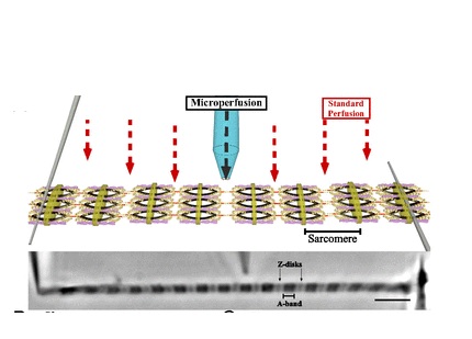 Des micro-aiguilles permettent aux chercheurs d'évaluer la force de la contraction musculaire Des micro-aiguilles permettent aux chercheurs d'évaluer la force de la contraction musculaire