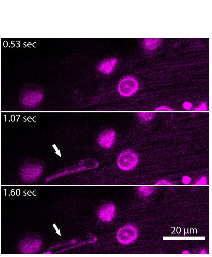 Les ENDS sont environ 100 fois plus détectables chez les patients septiques (Visuel Alex Marki, M.D., Ley Laboratory, La Jolla Institute for Immunology) Les ENDS sont environ 100 fois plus détectables chez les patients septiques (Visuel Alex Marki, M.D., Ley Laboratory, La Jolla Institute for Immunology)