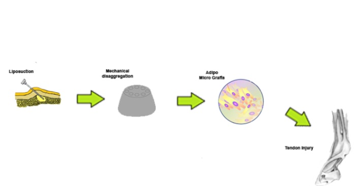 La fraction vasculaire stromale dérivée du tissu adipeux, contient des populations cellulaires hétérogènes telles que des cellules souches/progénitrices mésenchymateuses, des cellules endothéliales, des péricytes, des cellules T et des macrophages M2 (Visuel AlphaMed Press)