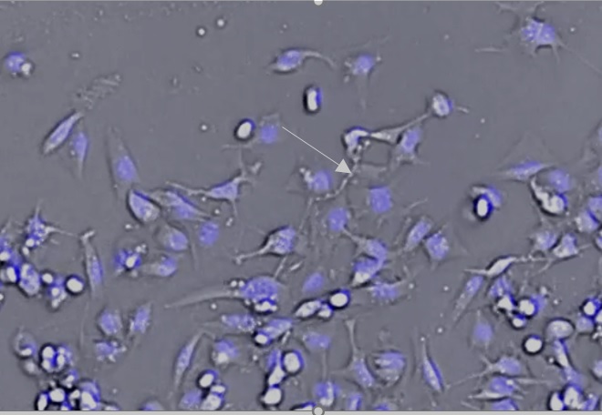 Ces cellules géantes utilisent des filaments cellulaires appelés vimentine pour migrer (PNAS) Ces cellules géantes utilisent des filaments cellulaires appelés vimentine pour migrer (PNAS)