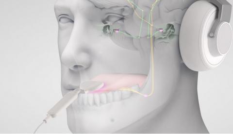 Ce dispositif de neuromodulation bimodale comprend des écouteurs et un petit réseau d'électrodes qui stimule la langue (Visuel Neuromod Devices Limited) Ce dispositif de neuromodulation bimodale comprend des écouteurs et un petit réseau d'électrodes qui stimule la langue (Visuel Neuromod Devices Limited)
