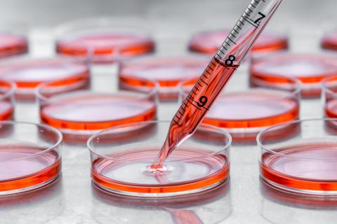 Comment le processus d’autophagie, un processus de nettoyage cellulaire peut être stimulé et comment il lutte contre l’athérosclérose, une cause majeure de crises cardiaques et d'accidents vasculaires cérébraux (Visuel Adobe Stock 102697862). Comment le processus d’autophagie, un processus de nettoyage cellulaire peut être stimulé et comment il lutte contre l’athérosclérose, une cause majeure de crises cardiaques et d'accidents vasculaires cérébraux (Visuel Adobe Stock 102697862).