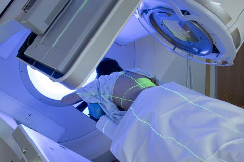 Certains traitements contre le cancer peuvent accélérer le vieillissement cellulaire par le biais de modifications épigénétiques (Visuel Adobe Stock 207188738) Certains traitements contre le cancer peuvent accélérer le vieillissement cellulaire par le biais de modifications épigénétiques (Visuel Adobe Stock 207188738)