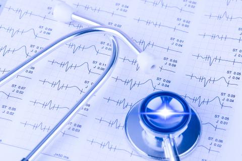 Une déclaration rédigée à l'intention des professionnels de la santé indique la conduite à tenir face à une arythmie associée au médicament (AdobeStock_229601539) Une déclaration rédigée à l'intention des professionnels de la santé indique la conduite à tenir face à une arythmie associée au médicament (AdobeStock_229601539)