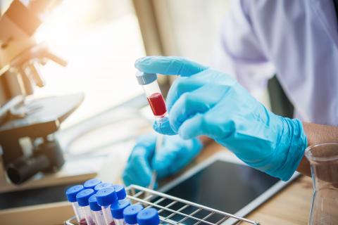 La métabolomique ou l’étude des métabolites pourrait être un ajout de plus dans la boîte à outils d'un médecin légiste (Visuel Adobe Stock 249482480) La métabolomique ou l’étude des métabolites pourrait être un ajout de plus dans la boîte à outils d'un médecin légiste (Visuel Adobe Stock 249482480)