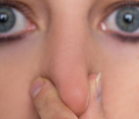 La perte d'odorat est signalée par les patients dans 86% des cas légers de COVID-19 (Visuel Adobe Stock 257463391) La perte d'odorat est signalée par les patients dans 86% des cas légers de COVID-19 (Visuel Adobe Stock 257463391)