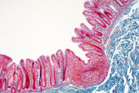 Le tofacitinib répare les défauts de perméabilité intestinale induits par l'inflammation Le tofacitinib répare les défauts de perméabilité intestinale induits par l'inflammation
