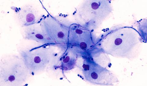 En décryptant ce processus dans la relation complexe entre les humains et les champignons du microbiote, cette étude désigne de nouvelles cibles qui pourraient aider à lutter contre l’émergence croissante d'agents pathogènes résistants aux médicaments (Visuel Adobe Stock 275831019) En décryptant ce processus dans la relation complexe entre les humains et les champignons du microbiote, cette étude désigne de nouvelles cibles qui pourraient aider à lutter contre l’émergence croissante d'agents pathogènes résistants aux médicaments (Visuel Adobe Stock 275831019)