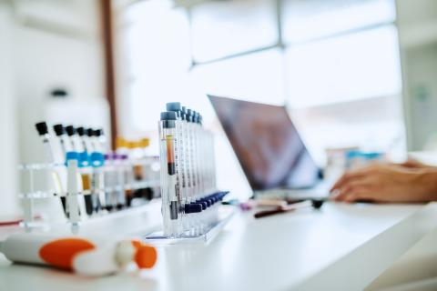 Les variations d'une enzyme présente dans une zone du cerveau qui régule l'humeur et la motivation, semble bien, chez les souris, contrôler les interactions sociales (Visuel adobe Stock 306513975) Les variations d'une enzyme présente dans une zone du cerveau qui régule l'humeur et la motivation, semble bien, chez les souris, contrôler les interactions sociales (Visuel adobe Stock 306513975)