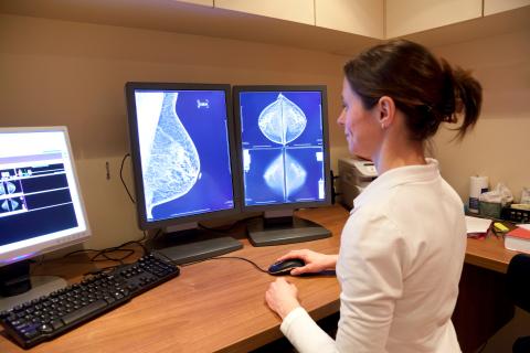 La détection d’une calcification artérielle mammaire est bien associée à des résultats d’angiographie indicatifs de maladie coronarienne et de maladie cardiovasculaire (Visuel Adobe Stock 30814686) La détection d’une calcification artérielle mammaire est bien associée à des résultats d’angiographie indicatifs de maladie coronarienne et de maladie cardiovasculaire (Visuel Adobe Stock 30814686)