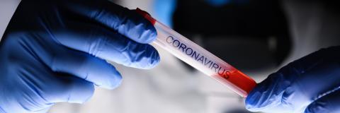 Une modélisation d’une équipe du John Hopkins confirme que les cas confirmés en laboratoire ne seraient que la pointe extrême de l’iceberg Une modélisation d’une équipe du John Hopkins confirme que les cas confirmés en laboratoire ne seraient que la pointe extrême de l’iceberg