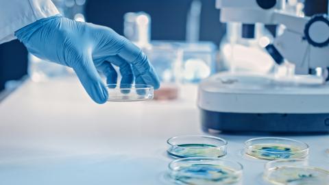 Cette équipe découvre un mécanisme de sévérité et de résistance de l’infection, conduit par des molécules de liaison aux cellules hôtes, les lectines (Visuel Adobe Stock 330354678) Cette équipe découvre un mécanisme de sévérité et de résistance de l’infection, conduit par des molécules de liaison aux cellules hôtes, les lectines (Visuel Adobe Stock 330354678)