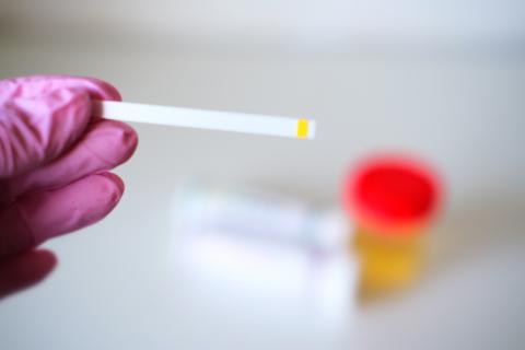 CANCER : Une bandelette urinaire pour le détecter