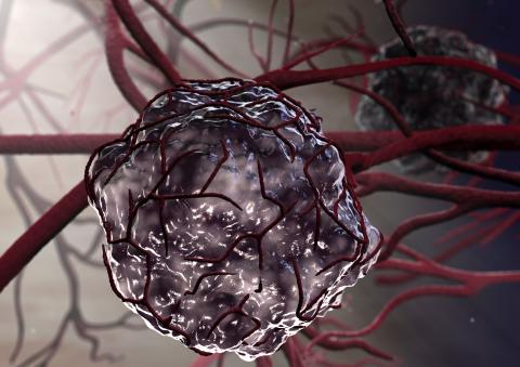 Un analogue de l'anti-angiogénique bevacizumab (Avastin®), le « QL1101 » est confirmé par cet essai clinique comme un traitement « efficient » donc plus rentable que le médicament « de référence » (Visuel Adobe Stock 41995222) Un analogue de l'anti-angiogénique bevacizumab (Avastin®), le « QL1101 » est confirmé par cet essai clinique comme un traitement « efficient » donc plus rentable que le médicament « de référence » (Visuel Adobe Stock 41995222)
