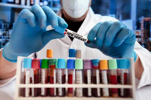 L'équipe poursuit la piste des inhibiteurs de la protéase, dont le principe, bien éprouvé contre le VIH, consiste à se lier sur le site actif de la protéase du virus, ce qui induit la formation de particules virales immatures donc non infectieuses (Adobe Stock 423691758) L'équipe poursuit la piste des inhibiteurs de la protéase, dont le principe, bien éprouvé contre le VIH, consiste à se lier sur le site actif de la protéase du virus, ce qui induit la formation de particules virales immatures donc non infectieuses (Adobe Stock 423691758)