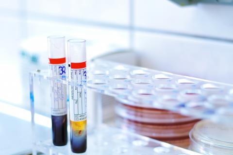 Le lipopolysaccharide, un facteur de virulence produit par des bactéries, est une toxine qui peut provoquer une inflammation systémique via la circulation sanguine (Visuel Adobe Stock 46851919) Le lipopolysaccharide, un facteur de virulence produit par des bactéries, est une toxine qui peut provoquer une inflammation systémique via la circulation sanguine (Visuel Adobe Stock 46851919)