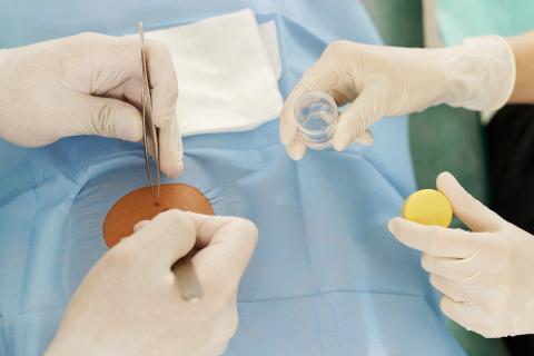Une biopsie cutanée pour identifier les patients atteints de la maladie de Parkinson (Visuel Adobe Stock 468969828) Une biopsie cutanée pour identifier les patients atteints de la maladie de Parkinson (Visuel Adobe Stock 468969828)