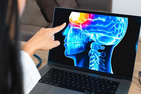 La lésion traumatique cérébrale entraîne un trouble dépressif cliniquement distinct avec des implications pour le traitement des patients (Visuel Adobe Stock 521036904) La lésion traumatique cérébrale entraîne un trouble dépressif cliniquement distinct avec des implications pour le traitement des patients (Visuel Adobe Stock 521036904)