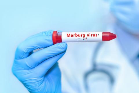 Ce candidat vaccin contre le virus de Marburg (MARV) induit une réponse immunitaire solide sans effet indésirable sévère (Visuel Adobe Stock 526156574) Ce candidat vaccin contre le virus de Marburg (MARV) induit une réponse immunitaire solide sans effet indésirable sévère (Visuel Adobe Stock 526156574)