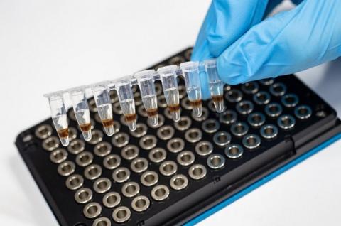Alors qu’il n’existe pas de traitement efficace de la maladie d’Alzheimer et que sa prévalence pourrait dépasser les 75 millions de personnes dans le monde, en 2030, l’espoir réside peut-être dans les thérapies géniques ? (Visuel Fotolia) Alors qu’il n’existe pas de traitement efficace de la maladie d’Alzheimer et que sa prévalence pourrait dépasser les 75 millions de personnes dans le monde, en 2030, l’espoir réside peut-être dans les thérapies géniques ? (Visuel Fotolia)