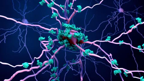L'étude confirme un début précoce et en profondeur de la maladie d'Alzheimer dans le cerveau L'étude confirme un début précoce et en profondeur de la maladie d'Alzheimer dans le cerveau