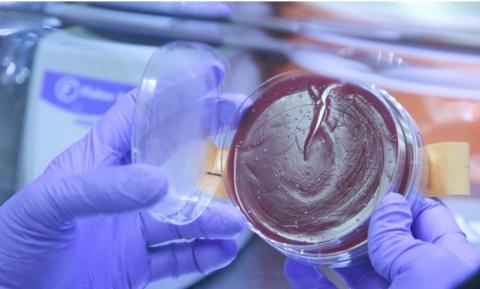 Comme « on parle » d’édition du génome, on parle aujourd’hui « d'édition du microbiote Comme « on parle » d’édition du génome, on parle aujourd’hui « d'édition du microbiote »