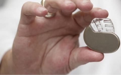 L'étude met en évidence les risques d'anxiété et de dépression après l’implatation d’un défibrillateur cardioverteur implantable (DCI) (Visuel NIH) L'étude met en évidence les risques d'anxiété et de dépression après l’implatation d’un défibrillateur cardioverteur implantable (DCI) (Visuel NIH)