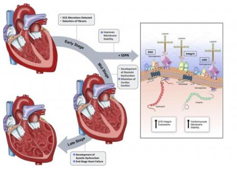 Une protéine, le sarcospan, pouvait contribuer à stabiliser les membranes des cellules cardiaques, qui deviennent fragiles chez les patients atteints de dystrophie musculaire de Duchenne. Une protéine, le sarcospan, pouvait contribuer à stabiliser les membranes des cellules cardiaques, qui deviennent fragiles chez les patients atteints de dystrophie musculaire de Duchenne.