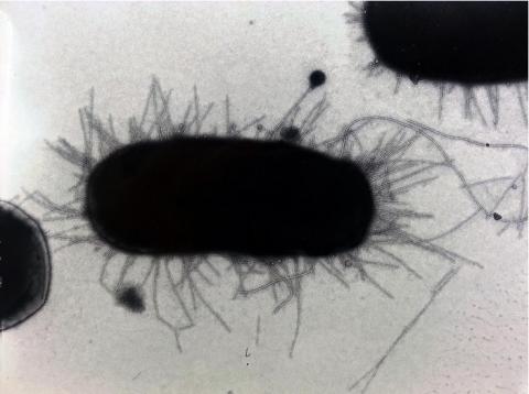 Les souches de superbactéries E. coli peuvent persister dans les intestins de femmes en bonne santé Les souches de superbactéries E. coli peuvent persister dans les intestins de femmes en bonne santé