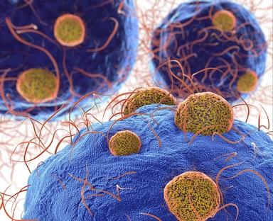 Des globules rouges bien particuliers car ils retiennent contrairement aux globules sains, des mini-centrales électriques cellulaires que sont les mitochondries, c’est la signature découverte chez des patients atteints de lupus sévère (Visuel Fotolia 80328195) Des globules rouges bien particuliers car ils retiennent contrairement aux globules sains, des mini-centrales électriques cellulaires que sont les mitochondries, c’est la signature découverte chez des patients atteints de lupus sévère (Visuel Fotolia 80328195).