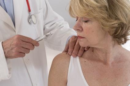 Ces données soutiennent l'utilisation de bloqueurs de points de contrôle immunitaires comme thérapies standard dans le carcinome épidermoïde cutané avancé (Visuel Fotolia 93980283) Ces données soutiennent l'utilisation de bloqueurs de points de contrôle immunitaires comme thérapies standard dans le carcinome épidermoïde cutané avancé (Visuel Fotolia 93980283)