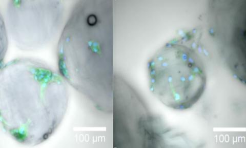 Des gouttes de gel de la taille d'un micromètre peuvent fournir l'architecture extracellulaire nécessaire, en médecine régénérative, à la croissance et à la prolifération des cellules au cours de la cicatrisation (Visuel 2021 KAUST ; Gustavo Ramírez Calderón.) Des gouttes de gel de la taille d'un micromètre peuvent fournir l'architecture extracellulaire nécessaire, en médecine régénérative, à la croissance et à la prolifération des cellules au cours de la cicatrisation (Visuel 2021 KAUST ; Gustavo Ramírez Calderón.)