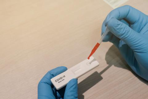 L'incidence du nouveau coronavirus dépendra d’un facteur clé : la durée de l'immunité humaine L'incidence du nouveau coronavirus dépendra d’un facteur clé : la durée de l'immunité humaine