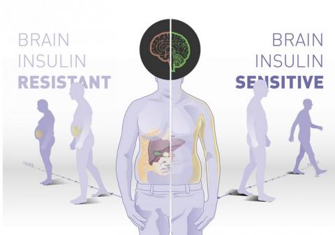 Les personnes ayant une sensibilité cérébrale élevée à l'insuline bénéficient beaucoup plus d'une intervention sur le mode de vie comportant un régime alimentation riche en fibres et la pratique de l’exercice Les personnes ayant une sensibilité cérébrale élevée à l'insuline bénéficient beaucoup plus d'une intervention sur le mode de vie comportant un régime alimentation riche en fibres et la pratique de l’exercice