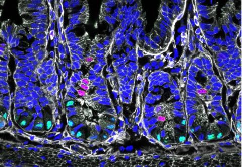 Les cellules souches intestinales constituent une grande partie du lien entre l'alimentation et la maladie métabolique et intestinale (Visuel Helmholtz Munich / Anika Böttcher) Les cellules souches intestinales constituent une grande partie du lien entre l'alimentation et la maladie métabolique et intestinale (Visuel Helmholtz Munich / Anika Böttcher)