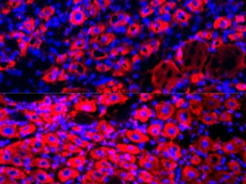 Un effet anti-âge par dilution du plasma sanguin ? (Visuel Irina Conboy) Un effet anti-âge par dilution du plasma sanguin ? (Visuel Irina Conboy)