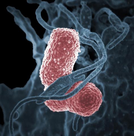 La bactérie K. pneumoniae ST258 fait partie de la liste des bactéries les plus résistantes, selon les CDC américains (Visuel NIAID) La bactérie K. pneumoniae ST258 fait partie de la liste des bactéries les plus résistantes, selon les CDC américains (Visuel NIAID)