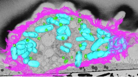 Les graisses ne servent pas seulement à stocker de l’énergie mais elles permettent aussi à nos cellules de combattre les bactéries (Visuel Institute for Molecular Bioscience, University of Queensland) Les graisses ne servent pas seulement à stocker de l’énergie mais elles permettent aussi à nos cellules de combattre les bactéries (Visuel Institute for Molecular Bioscience, University of Queensland)