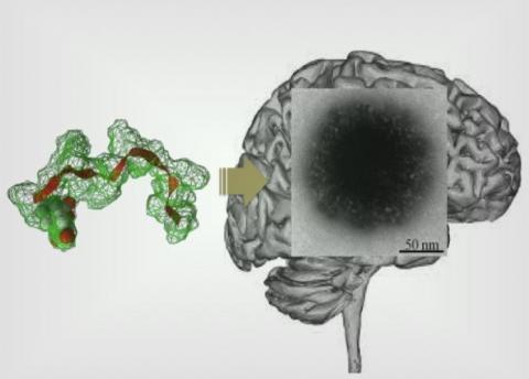 Un auto-assemblage peptidique, « à poils », va délivrer l'agent actif dans le cerveau Un auto-assemblage peptidique, « à poils », va délivrer l'agent actif dans le cerveau