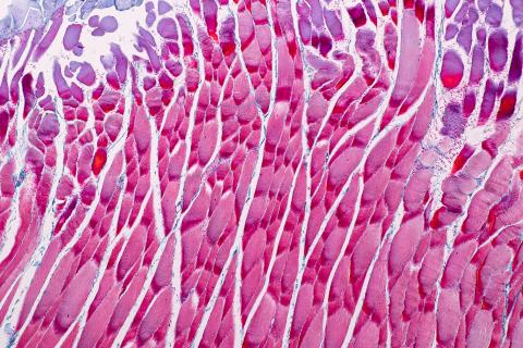 Titine est la plus grande protéine du corps et la plus abondante dans le muscle strié. Titine est la plus grande protéine du corps et la plus abondante dans le muscle strié.