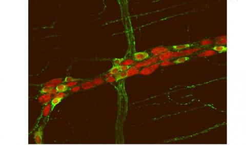 Les mêmes mutations génétiques - découvertes à la fois dans le cerveau et dans les intestins - pourraient être la cause commune des problèmes intestinaux et des dysfonctionnements cérébraux constatés dans l’autisme. Les mêmes mutations génétiques - découvertes à la fois dans le cerveau et dans les intestins - pourraient être la cause commune des problèmes intestinaux et des dysfonctionnements cérébraux constatés dans l’autisme.