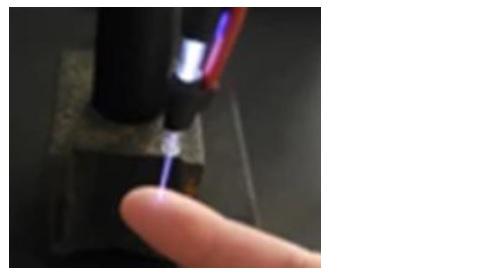Un jet de plasma à pression atmosphérique, applicable sur des tissus vivants sans dommages thermiques, peut être efficace pour la stérilisation et l’élimination des bactéries résistantes aux antibiotiques. Un jet de plasma à pression atmosphérique, applicable sur des tissus vivants sans dommages thermiques, peut être efficace pour la stérilisation et l’élimination des bactéries résistantes aux antibiotiques.