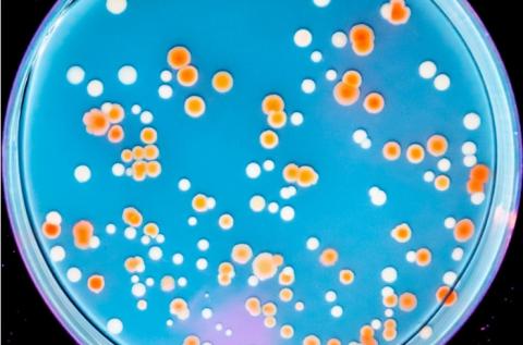 Mais comment la radiorésistance aurait-elle pu évoluer dans plusieurs organismes de notre planète, naturellement protégés du rayonnement solaire par son champ magnétique ? (Visuel Michael M. Cox and coauthors ) Mais comment la radiorésistance aurait-elle pu évoluer dans plusieurs organismes de notre planète, naturellement protégés du rayonnement solaire par son champ magnétique ? (Visuel Michael M. Cox and coauthors )