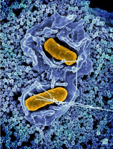 La tentative du système immunitaire d'éliminer les bactéries Salmonella du tractus gastro-intestinal facilite plutôt la colonisation du tractus intestinal et l'excrétion fécale (Visuel NIAID). La tentative du système immunitaire d'éliminer les bactéries Salmonella du tractus gastro-intestinal facilite plutôt la colonisation du tractus intestinal et l'excrétion fécale (Visuel NIAID).