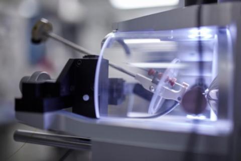 27 protéines du sang ont été identifiées par spectrométrie de masse, qui permettent de prédire la progression de COVID-19 (Visuel Arne Sattler/Charité) 27 protéines du sang ont été identifiées par spectrométrie de masse, qui permettent de prédire la progression de COVID-19 (Visuel Arne Sattler/Charité)