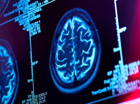 Maux de tête, lésions cérébrales traumatiques, épilepsie, maladie de Parkinson, maladie d'Alzheimer et plus encore, ce type de stimulation non invasive qui fait déjà l’objet de nombreuses recherches, promet un très large spectre d’indications dans le traitement des troubles neurologiques (Visuel NIH-ABBOTT) Maux de tête, lésions cérébrales traumatiques, épilepsie, maladie de Parkinson, maladie d'Alzheimer et plus encore, ce type de stimulation non invasive qui fait déjà l’objet de nombreuses recherches, promet un très large spectre d’indications dans le traitement des troubles neurologiques (Visuel NIH-ABBOTT)